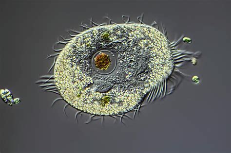  Xenosporidium! The Ciliate Parasite That Makes Its Home In Other Creatures